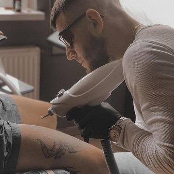 Премахване на татуировки във Варна