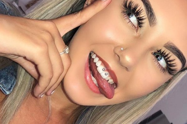 Smile пиърсинг