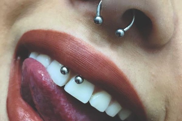Smile пиърсинг
