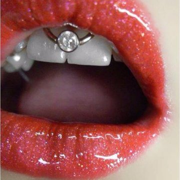 Smile пиърсинг