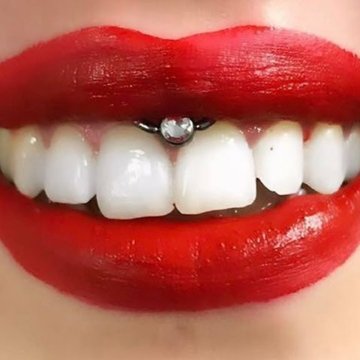 Smile пиърсинг
